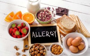 The Challenge of Food Allergies at Summer Camp